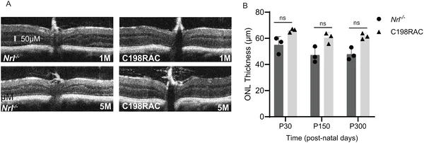 Images and measurements show retinal layer thickness in C198RAC and Nrl -/- mice at different ages, revealing no significant differences.