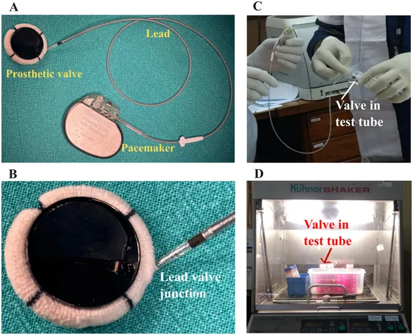 Setup showing an electrically activated prosthetic valve connected to a pacemaker, tested in blood at 35°C for 30 minutes to check blood compatibility.