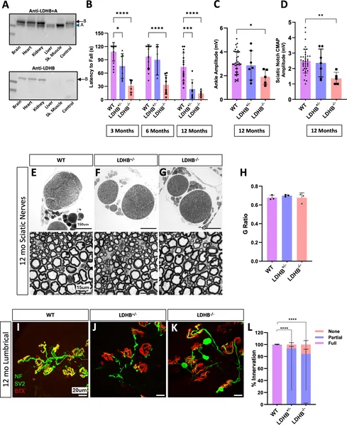 Removing LDHB in mice leads to worsening movement problems and nerve-muscle connection issues but doesn't harm nerve fibers.