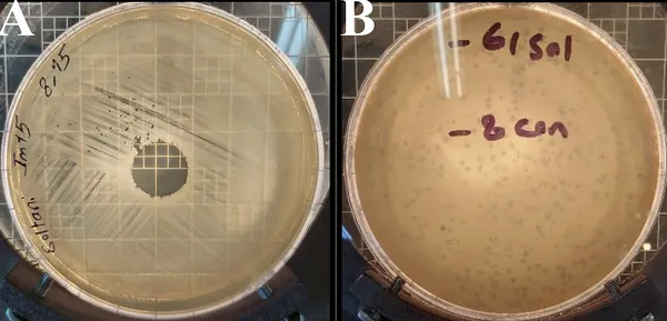 Bacteriophage Halo KS-7 kills Klebsiella pneumoniae bacteria, shown by clear spots and plaques on bacterial layers.