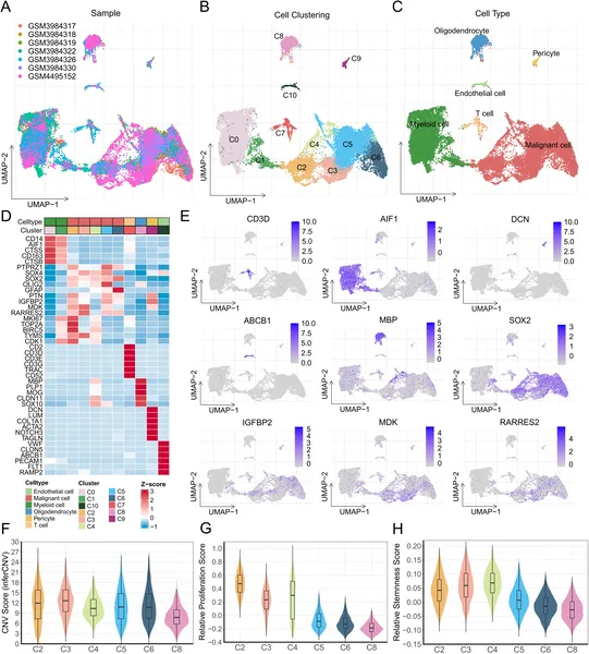 A detailed map shows different cell types and key gene activity in glioma tumors, highlighting variations in cell growth and characteristics.