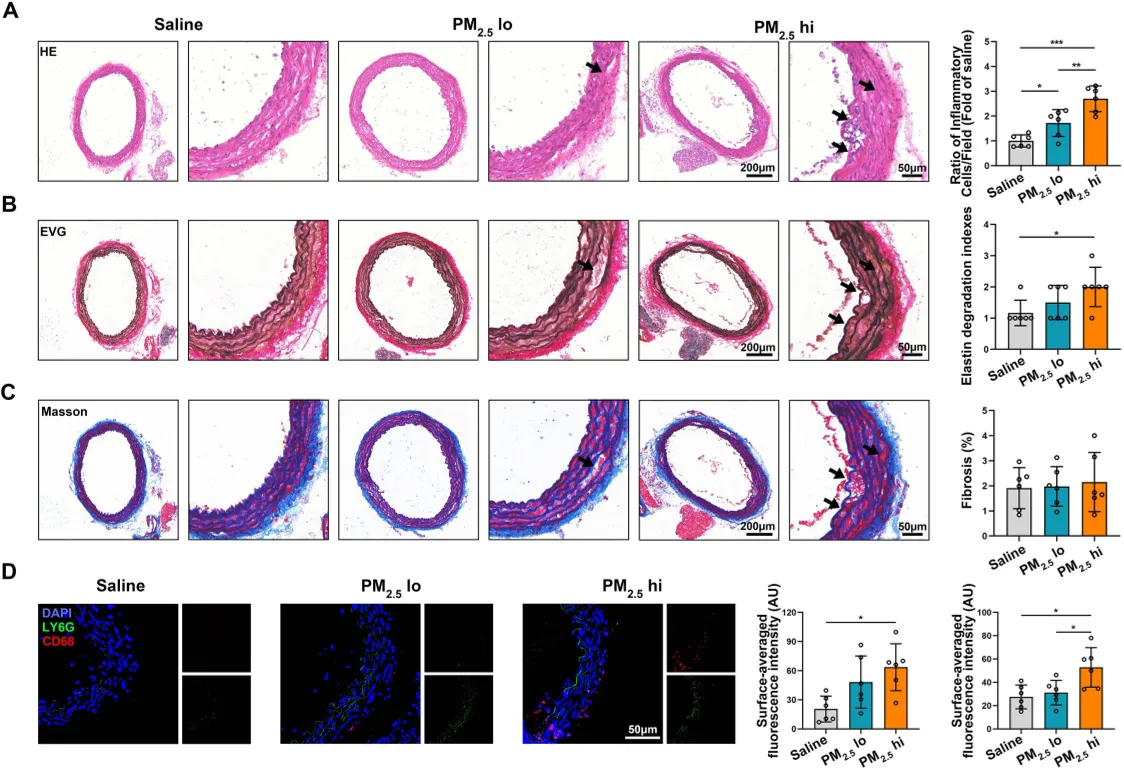 Higher PM2.5 exposure in mice causes more aortic inflammation, tissue damage, and collagen buildup, shown by stained tissue images and cell markers.