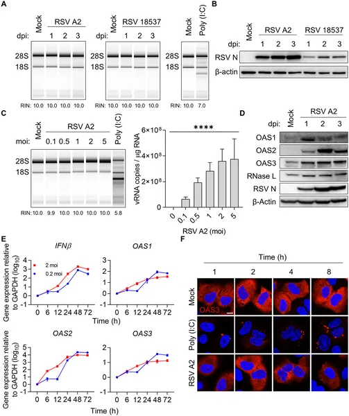 RSV infection in lung cells does not activate the OAS-RNase L antiviral pathway, shown by RNA, protein, and imaging analyses.