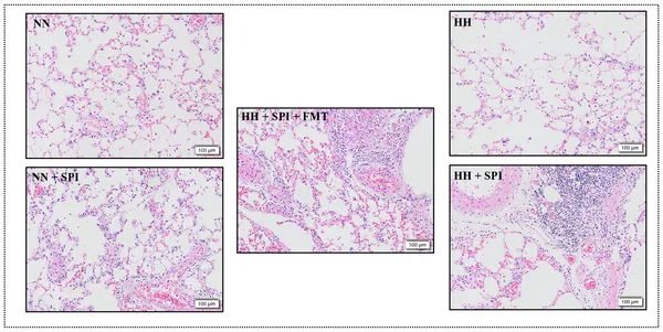 FMT treatment reduced lung inflammation in rats infected with pneumonia under low oxygen conditions.