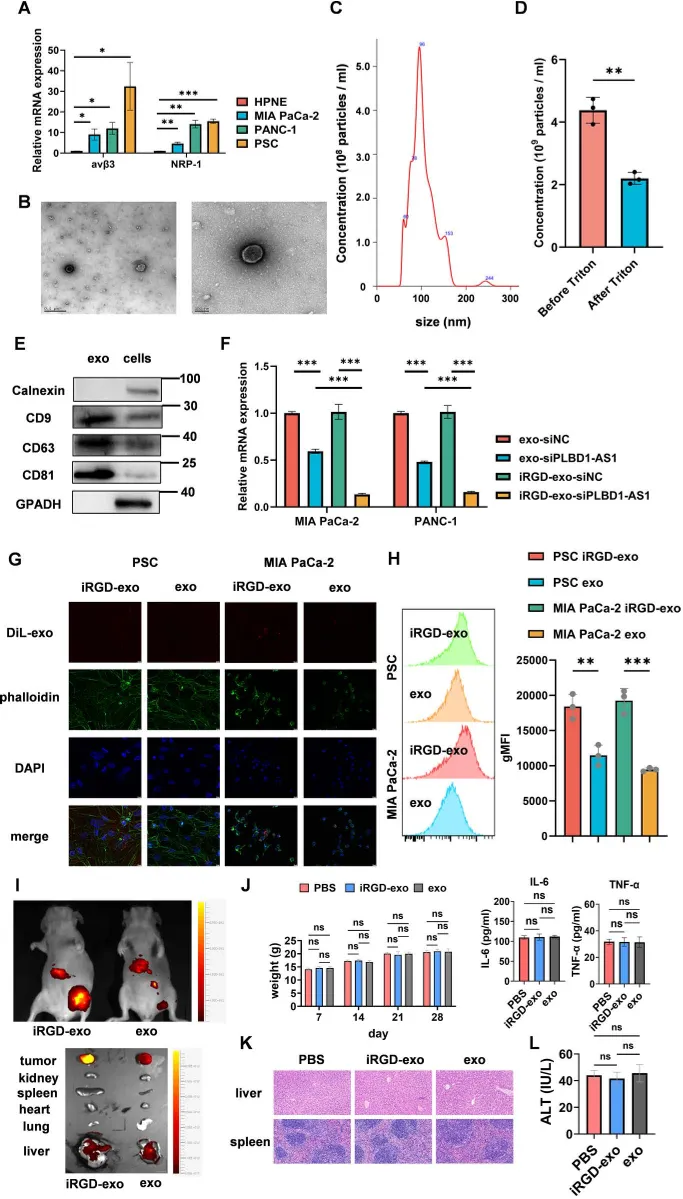 We prepared and confirmed targeted exosomes carrying siPLBD1-AS1, showing their size, structure, and key protein markers across different cell types.