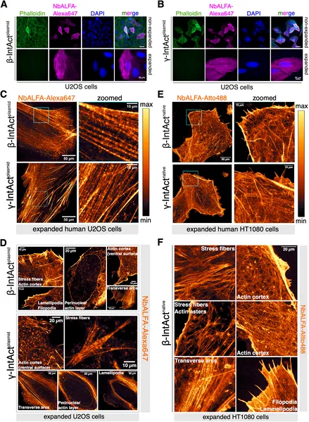 IntAct-U-ExM reveals detailed, isoform-specific actin networks in human cells using advanced imaging techniques.
