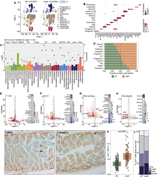 NOD2 deficiency changes gene activity in various intestinal cells, affecting immune and epithelial cell functions compared to normal controls.