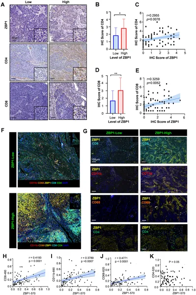 Higher ZBP1 levels in head and neck cancer tissues link to more immune cells like CD8+ and CD4+ T cells, macrophages, and myeloid cells.