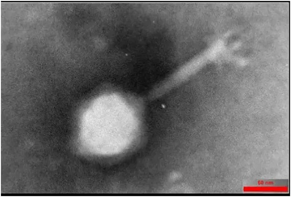 Electron microscope image showing the detailed head and tail structure of the Halo KS-7 virus, with a scale bar of 60 nm.