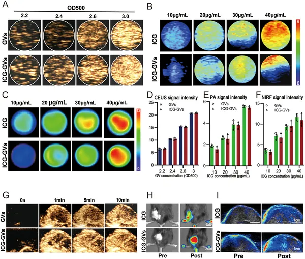 Images show how ICG-GVs improve ultrasound, photoacoustic, and fluorescence signals in lab tests and tumor-bearing mice.