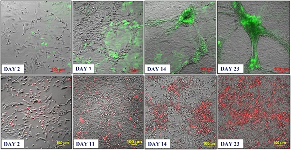 Endothelial and cancer cells grown together form 3D networks with cancer cells clustering inside after about 3 weeks in culture.
