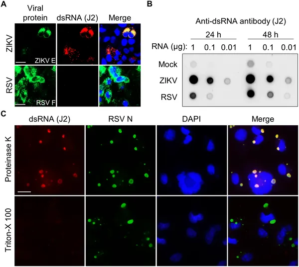Images show how RSV and ZIKV viruses trap double-stranded RNA inside infected cells, highlighting virus-specific structures and RNA detection methods.
