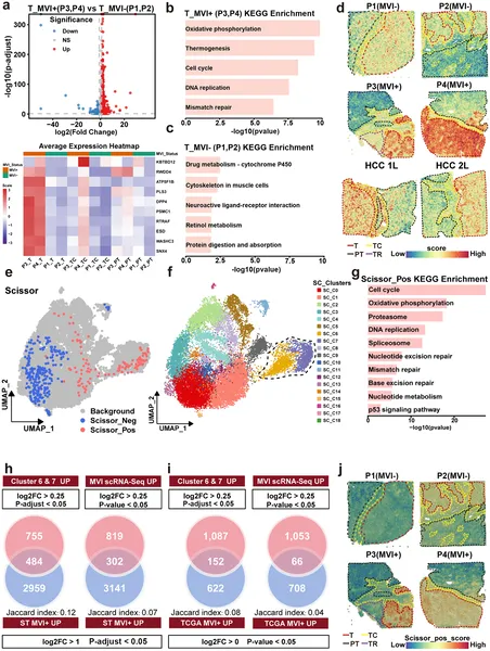 Gene activity and cell clusters differ between tumors with and without microvascular invasion, revealing unique pathways and cell types linked to tumor spread.