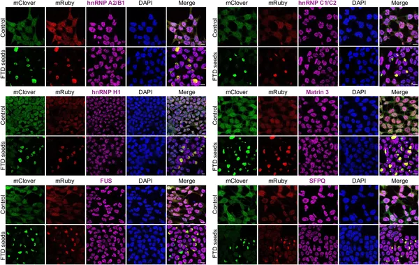 Protein partners of TDP-43 do not join abnormal aggregates in cells treated with disease-related seeds, shown by fluorescent microscopy.