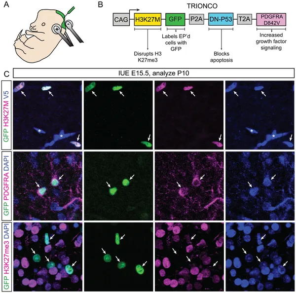 Images show successful delivery and expression of cancer-related proteins in mouse brains using a special DNA tool and electrical pulses.