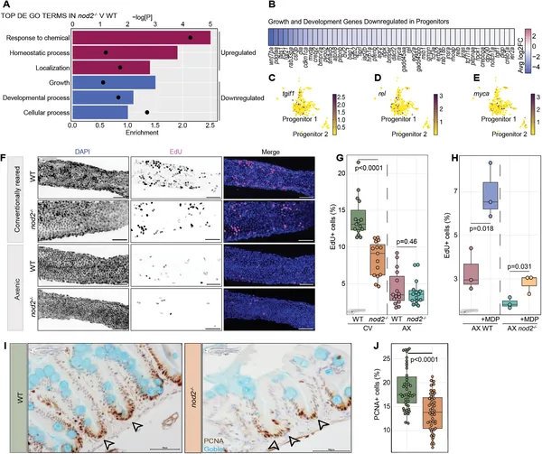 Nod2 deficiency reduces intestinal growth and cell proliferation in larval intestines compared to normal controls, shown by gene activity and cell imaging.