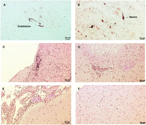 Virus proteins and brain damage were found in key brain areas after infection, while healthy brains showed no damage.