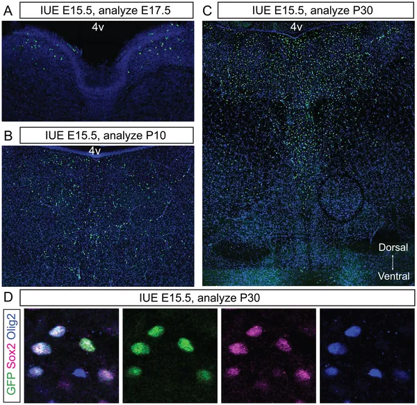 Mice with TRIONCO show growing brain tumors with pDMG traits, spreading from few cells at E17.5 to thousands by P30 in the pons region.