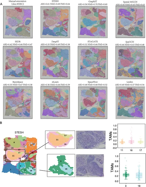 Fig 4 shows how STESH better identifies regions and tumor-related cells in human breast cancer tissue compared to other methods.