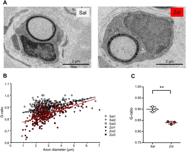 Zolmitriptan treatment boosts nerve fiber insulation in mice, shown by detailed nerve images and measurements of nerve thickness ratios.