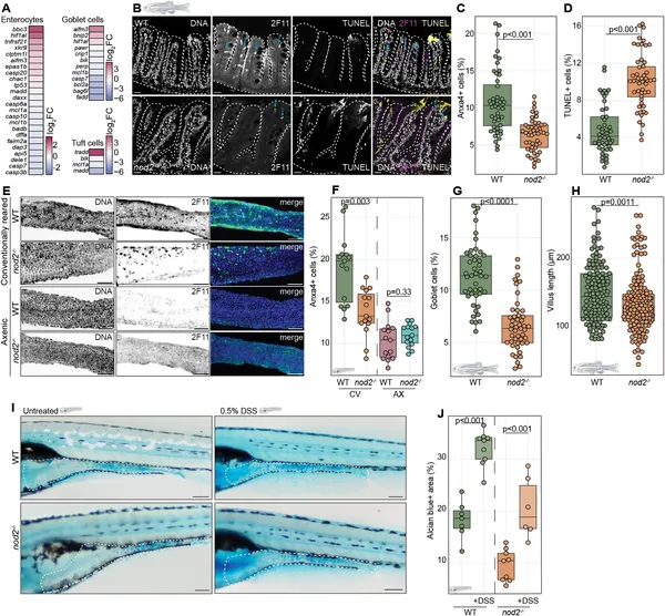 Loss of nod2 gene changes cell death and cell types in intestines, affecting gut health in zebrafish at different stages and conditions.