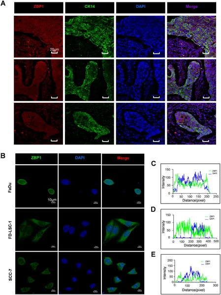 ZBP1 protein is found in both tumor and surrounding cells in head and neck cancer, showing different patterns inside human and mouse cells.