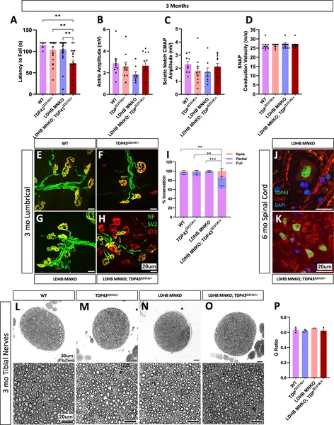 Removing LDHB in motor neurons worsens early movement and nerve connection problems in mice with TDP43 mutation.